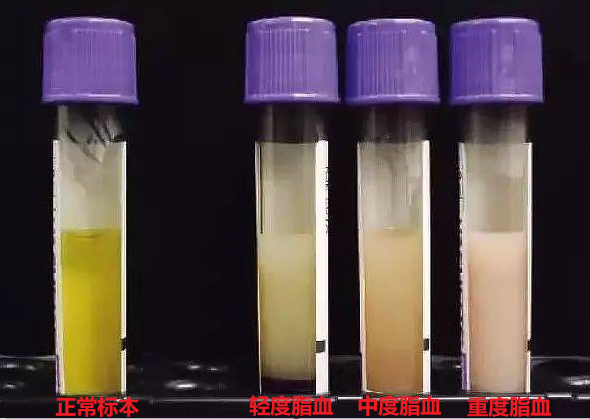 关于TG在生物化学中是什么意思的信息